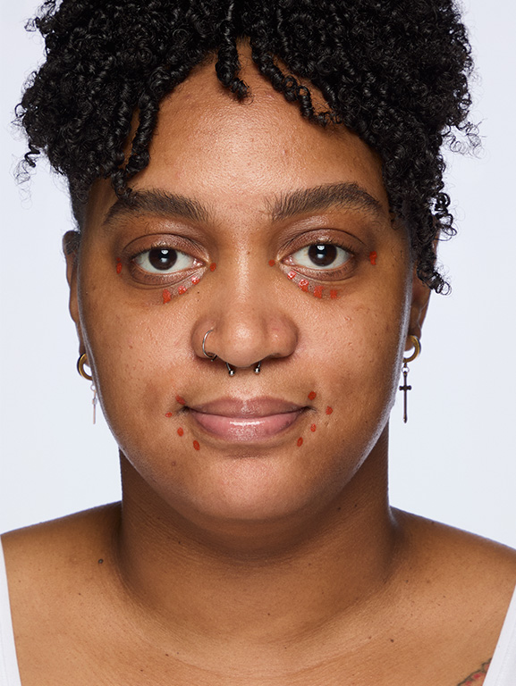 Day 1 of woman before application of Miracle Set.